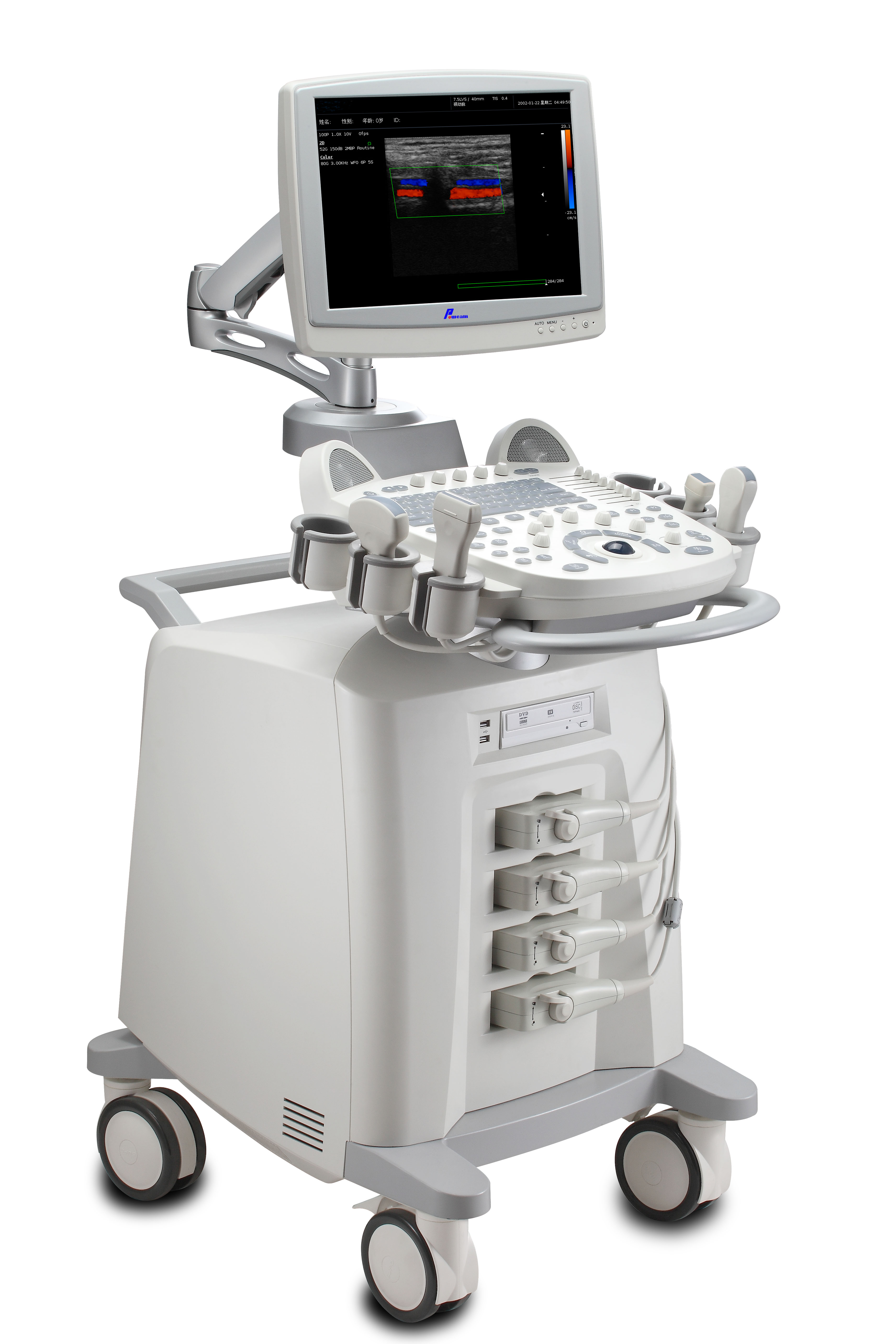 Hospital Medical Portable And Mobile Sonoscape 4D Color Doppler