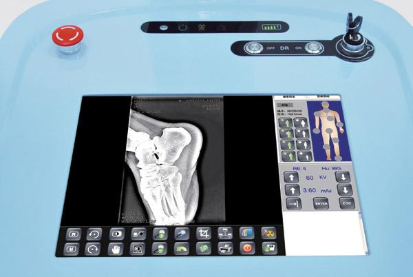 Hosipital High Frequency Mobile Digital Radiography System